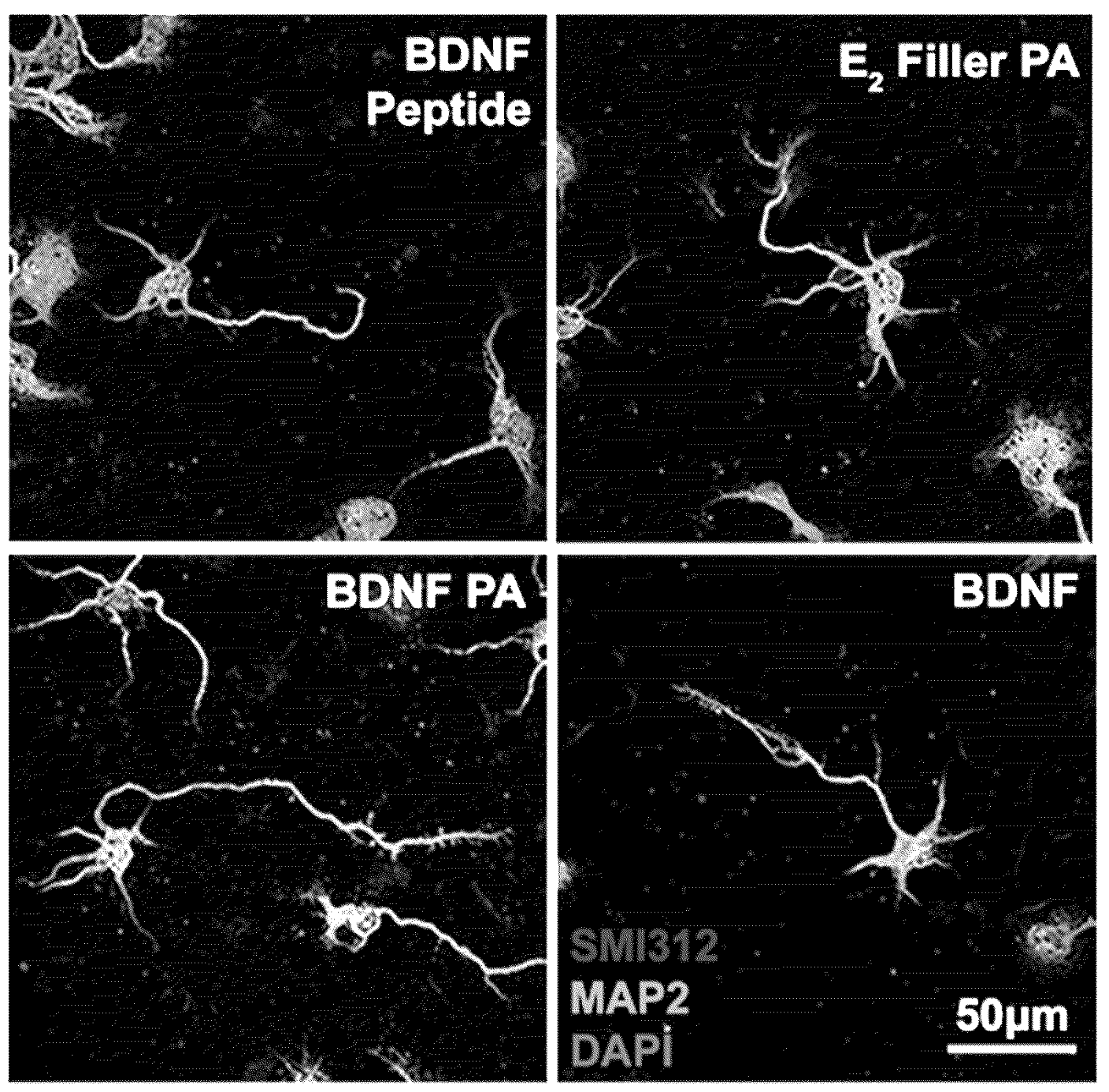 Confocal images of neuronal cells treated with BDNF peptide, E2 PA, BDNF PA, and BDNF protein for 24 h in vitro
