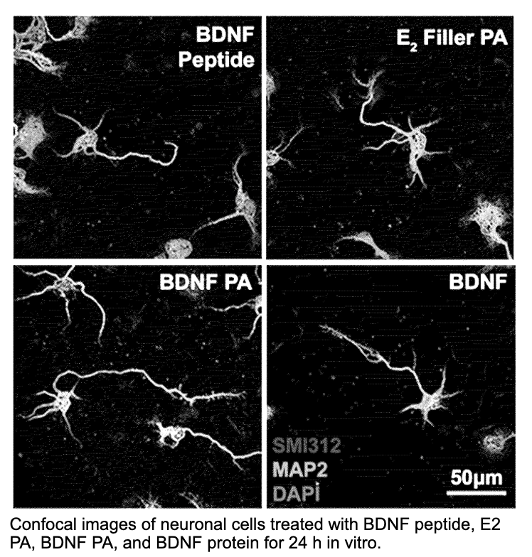 Confocal images of neuronal cells treated with BDNF peptide, E2 PA, BDNF PA, and BDNF protein for 24 h in vitro.