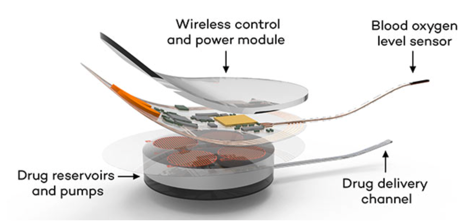 Closed-Loop Implantable System for Automated Opioid Overdose Detection and Reversal