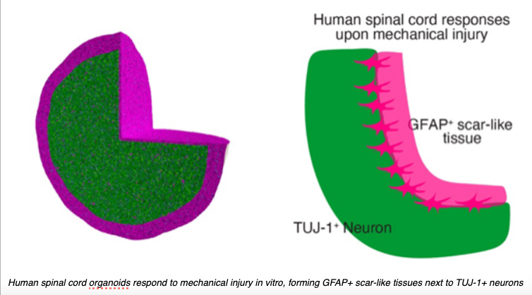 Human spinal cord organoids respond to mechanical injury in vitro, forming GFAP+ scar-like tissues next to TUJ-1+ neurons