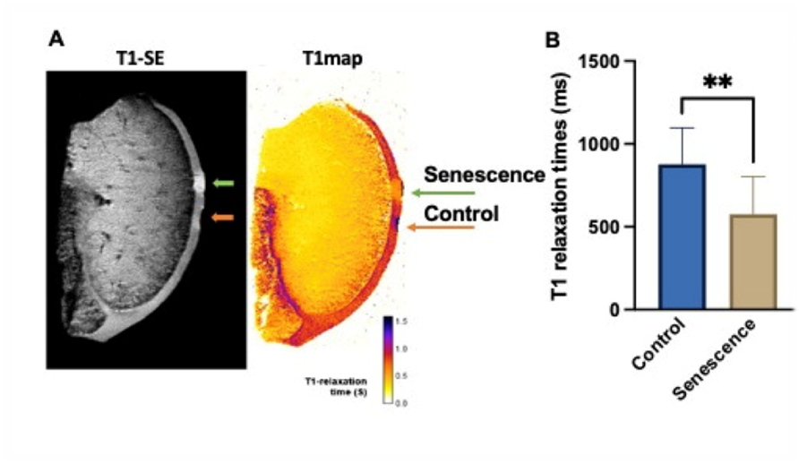 Senescent and control cells in the distal femur of porcine explants detected by B-gal responsive Gd-chelate.